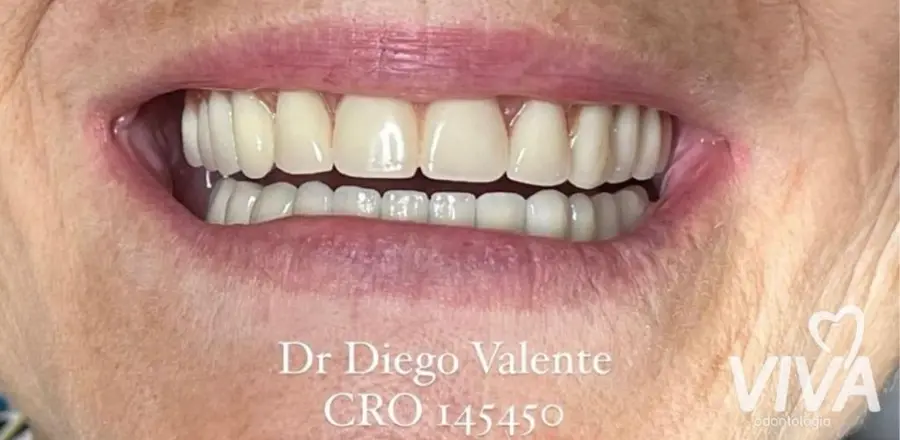 Caso 1: sorriso depois do tratamento